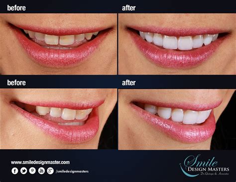 Innovative Solutions for Seamless Smile Transformations